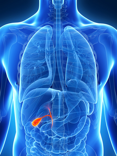 Gallstone Surgery London